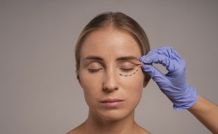 "Temporal lift hem genç hem doğal gösteriyor"